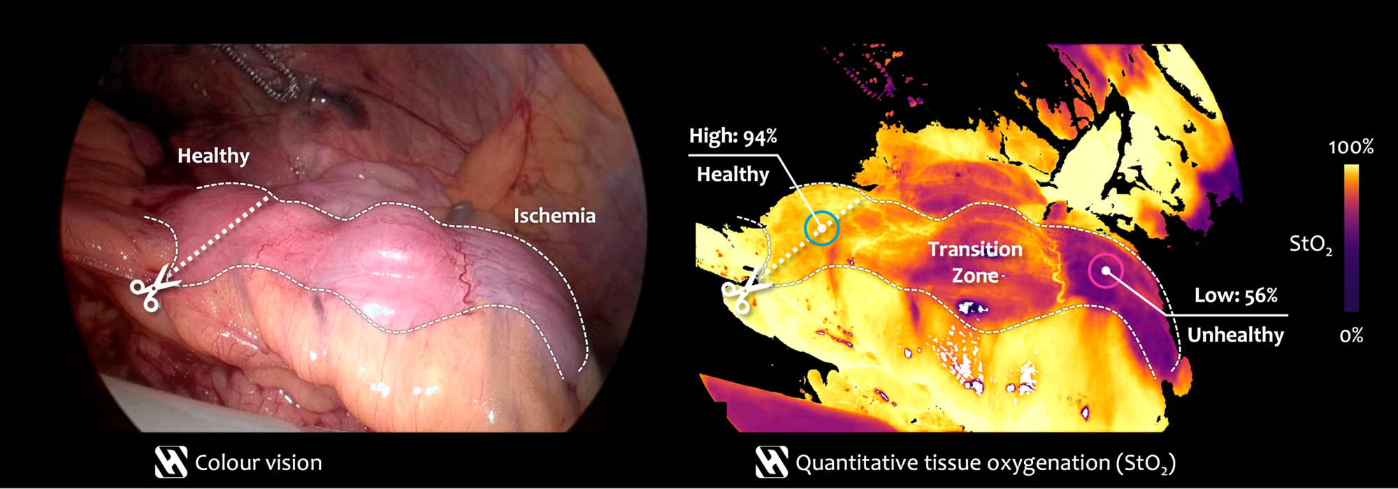 Colorectal Surgery